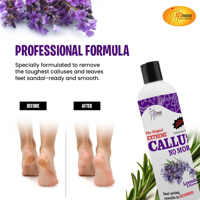 Spa Redi - Callus Remover - Lavender & Rosemary 12 oz