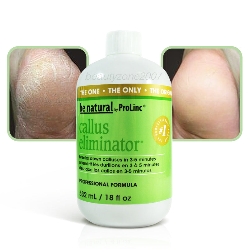 ProLinc - Eliminador de callos 18 oz