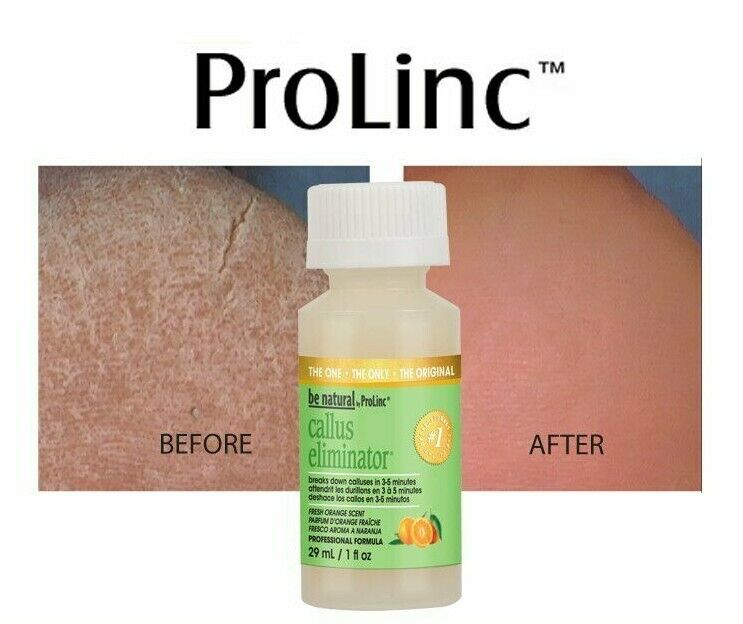 ProLinc - Eliminador de Callos 1 oz Naranja (2 Botellas)