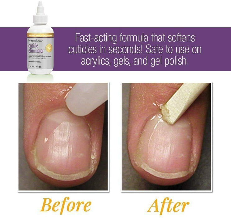 ProLinc - Cuticle Eliminator 4oz