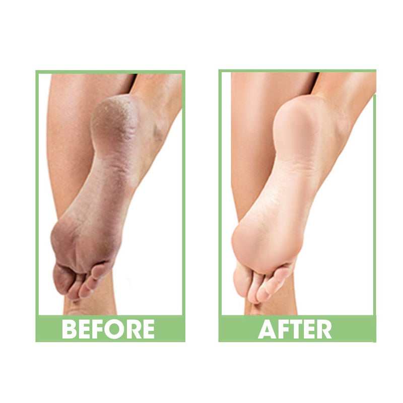 ProLinc - Dry Heel Eliminator + Cuticle Eliminator 4 oz