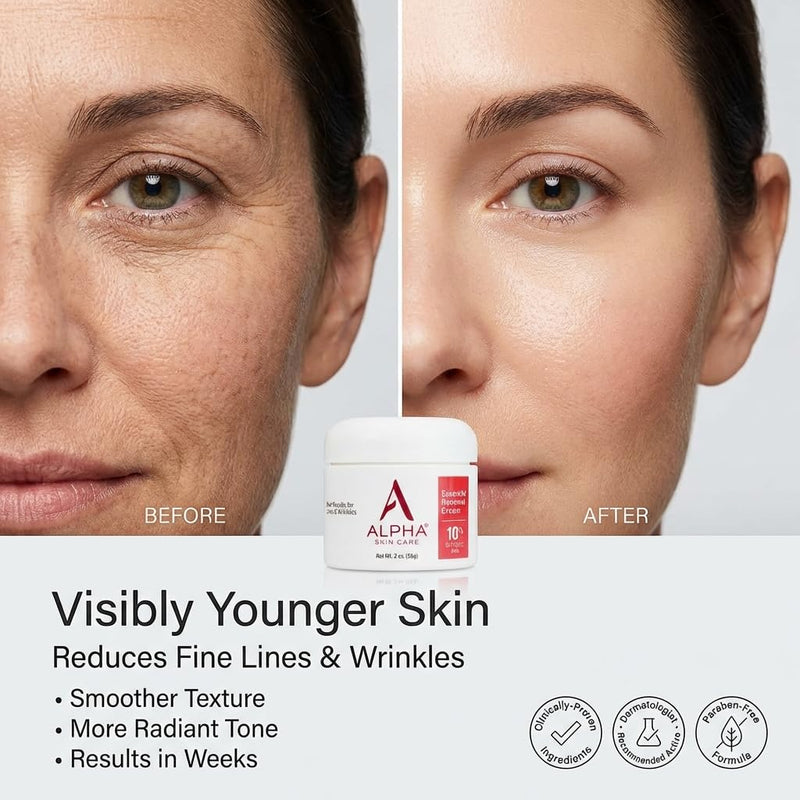 Alpha Skin Care - Essential Renewal Cream 10% Glycolic AHA 2 oz