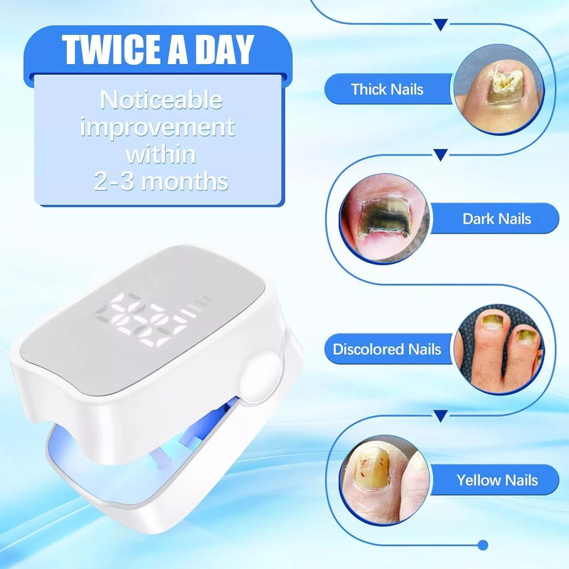 Nail Fungus Laser Treatment LED Light Device-FSA or HSA Eligible Solution-White