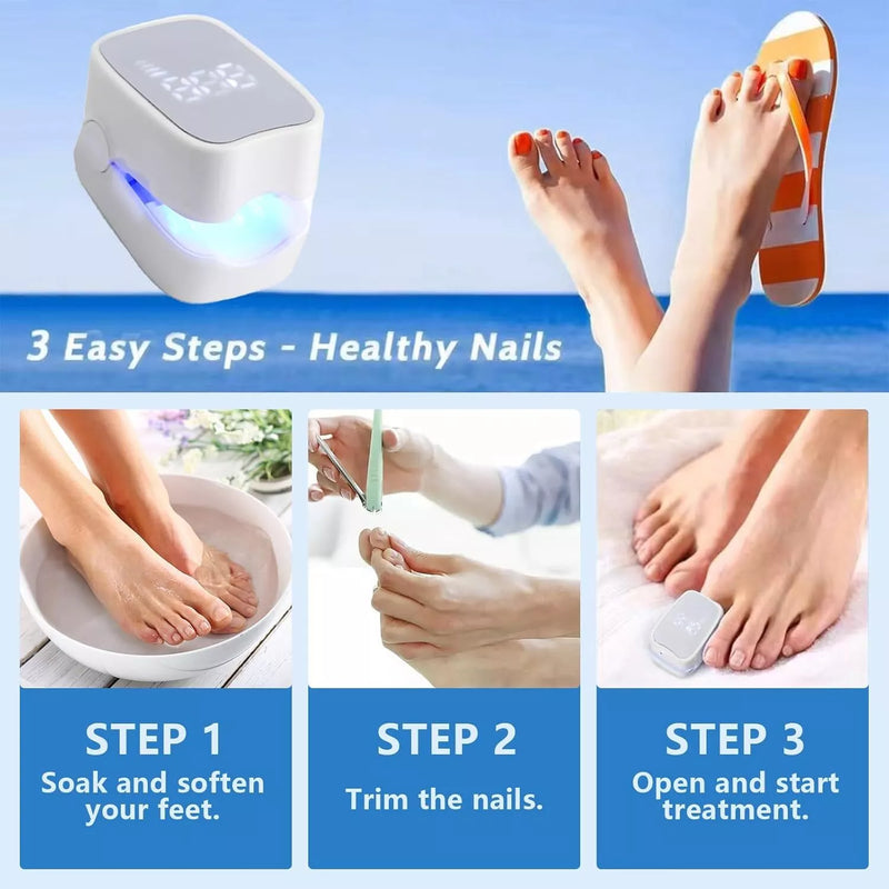 Nail Fungus Laser Treatment LED Light Device-FSA or HSA Eligible Solution-White
