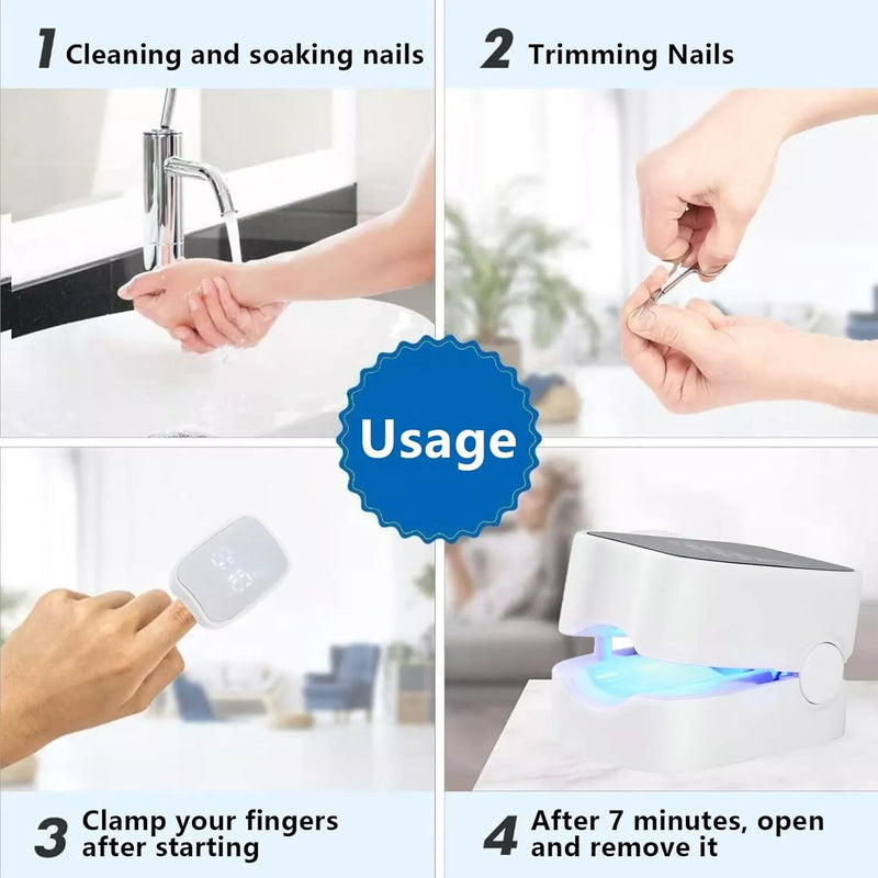Nail Fungus Laser Treatment LED Light Device-FSA or HSA Eligible Solution-White