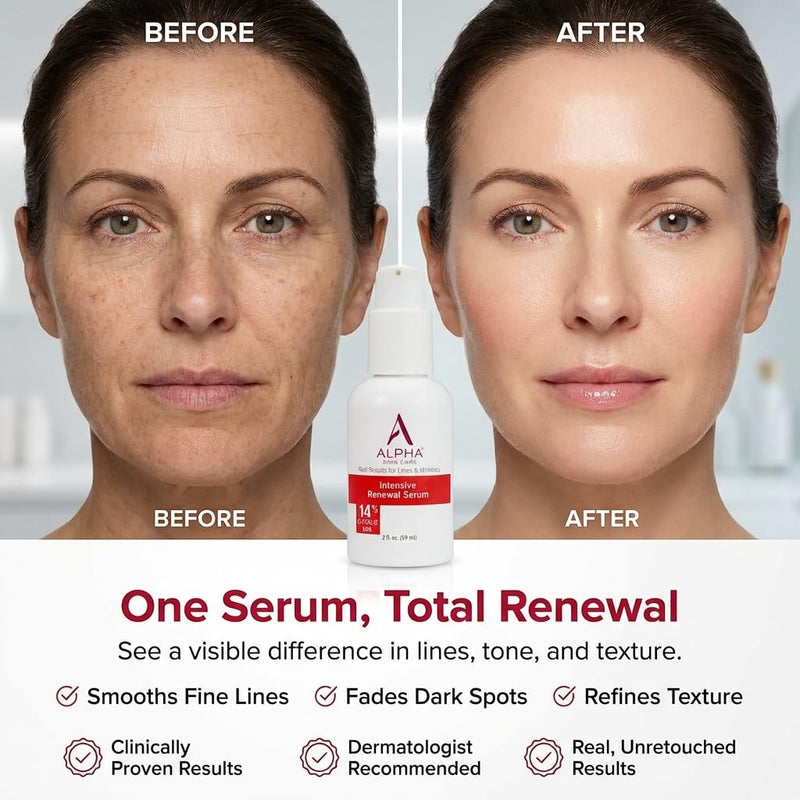 Alpha Skin Care - Suero Renovador 14% Ácido Glicólico AHA 2 oz (Paquete de 2) 