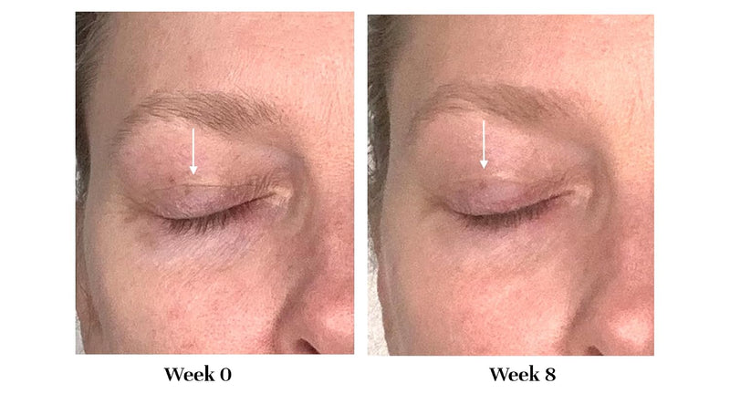 City Beauty - Lid Lifting Treatment - Eyelid Firming Eye Cream 0.33oz