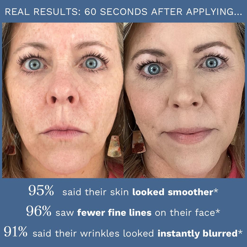 City Beauty - Line-Blurring Wrinkle Filler - for Face Spot Treatment 0.25oz