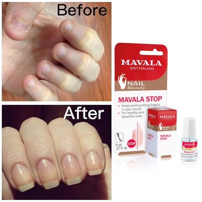 Mavala - Stop Deterrent Nail Treatment | to Help Stop Putting 0.17 oz