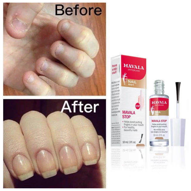 Mavala - Stop Deterrent Nail Treatment | to Help Stop Putting 0.3 oz