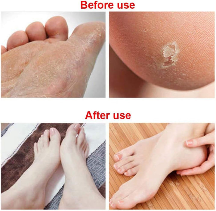 Sunny - Deluxe Metal Foot File - Replacement Blade (5 pcs)