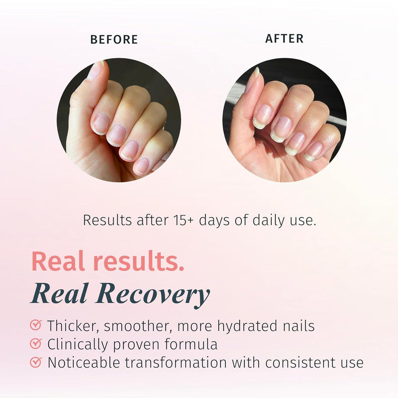 Duri - Rejuvacote 1 Nail Growth System 0.45 oz (6 Pack)