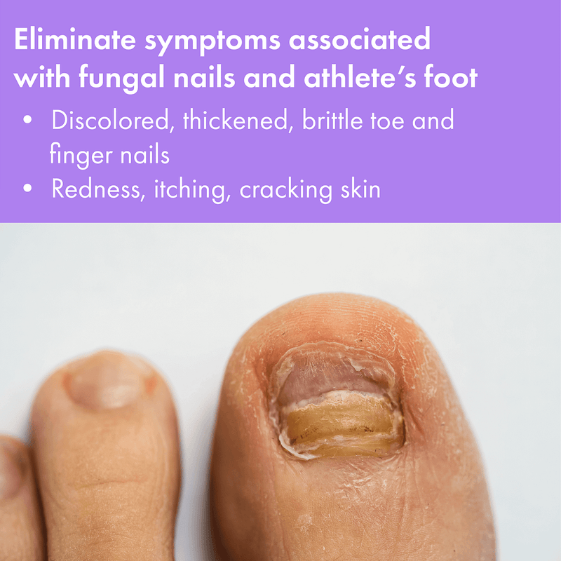 Vite20 - Brush-On Antifungal Kills Fungus (2 Pack)