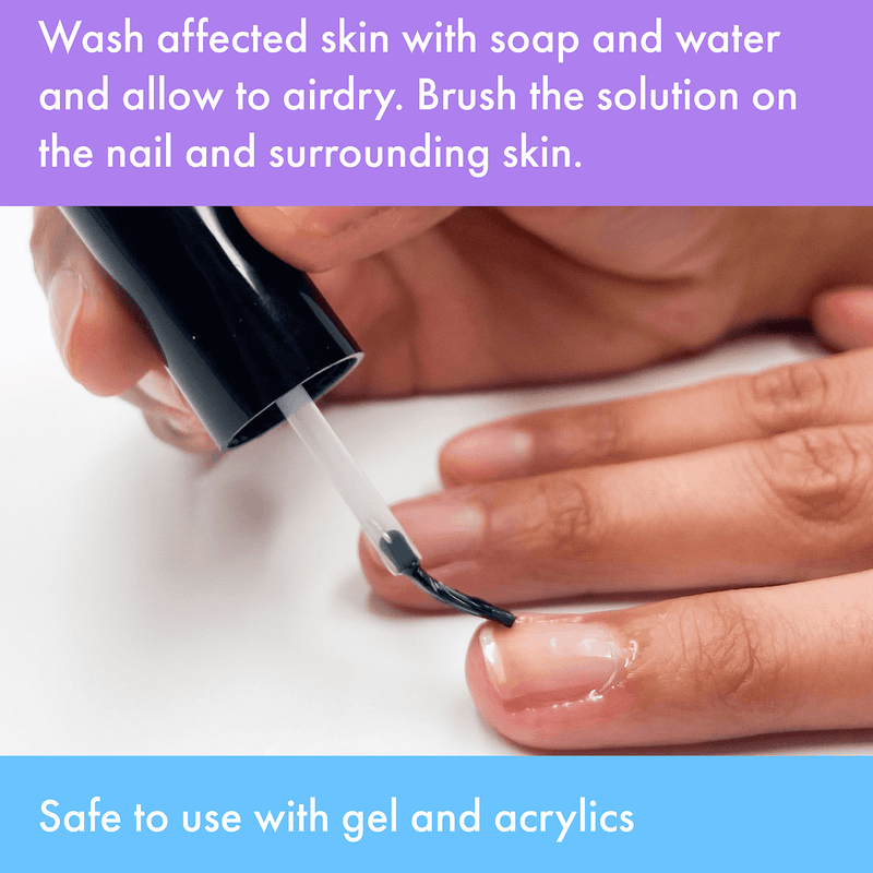 Vite20 - Brush-On Antifungal Kills Fungus