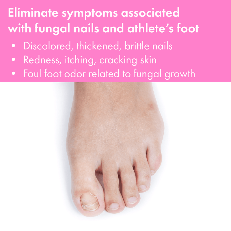 Vite20 - Antifungal Kills Fungus 0.54 oz (Cream) (12 Pack)