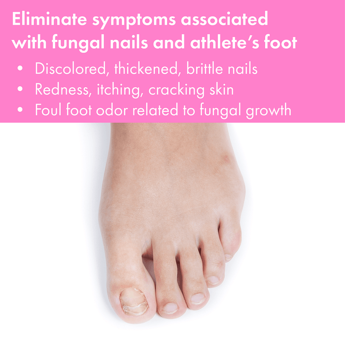 Vite20 - Antifungal Kills Fungus (Cream)