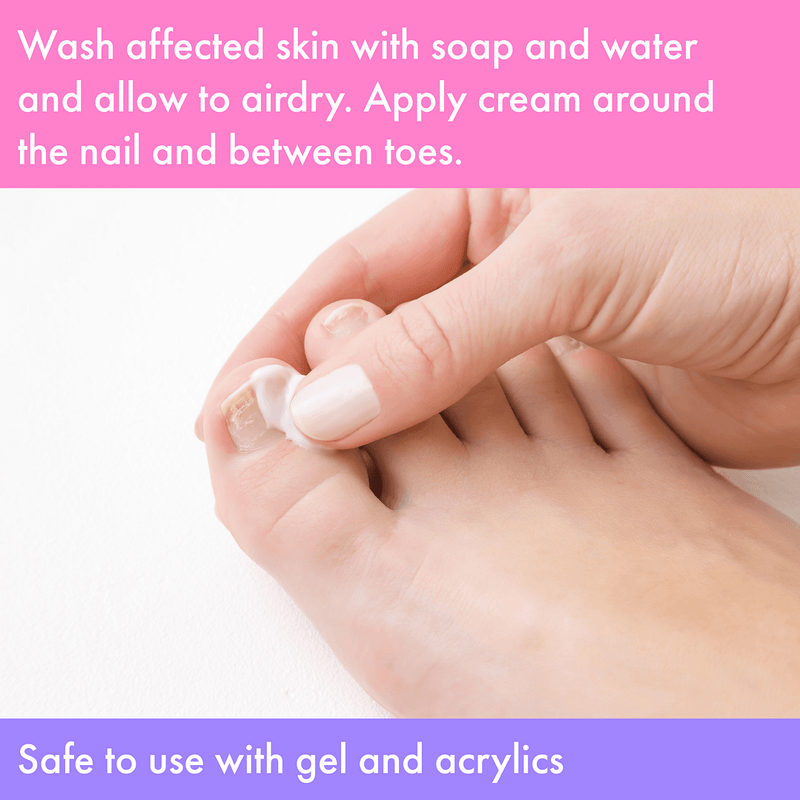 Vite20 - Antifungal Kills Fungus (Cream)