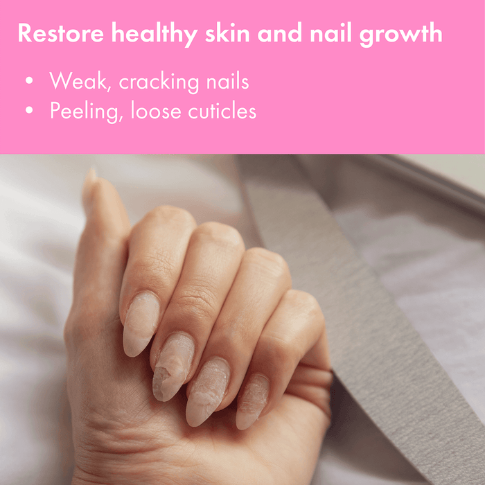Vite20 - Antifungal Kills Fungus (Gel)