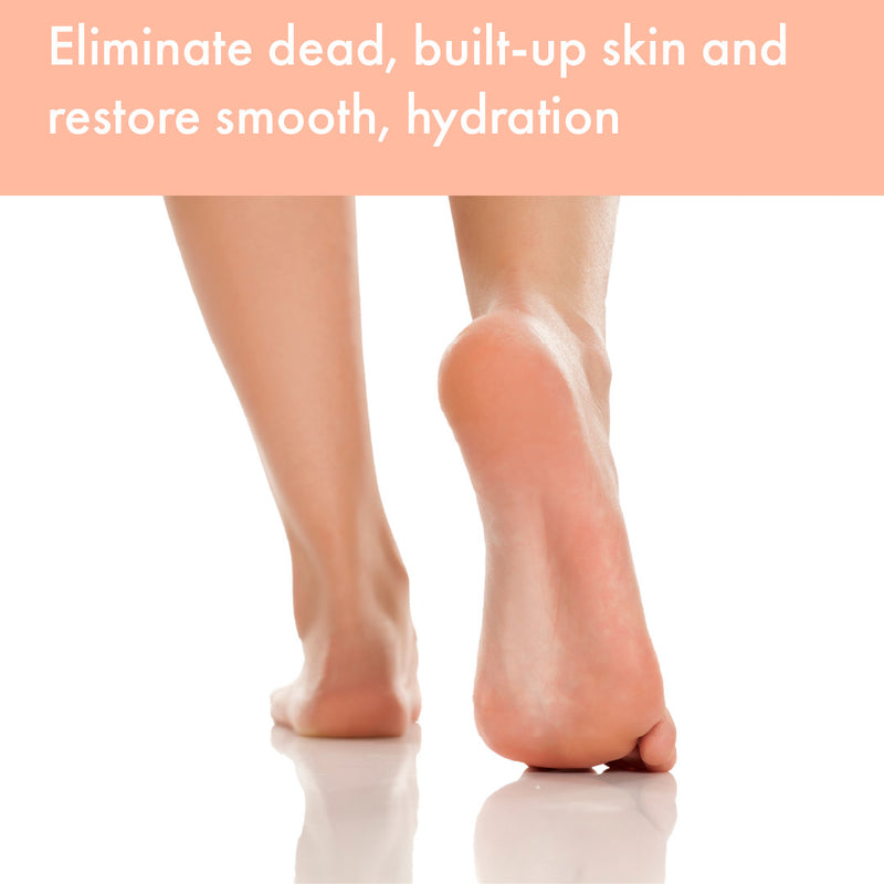 Vite20 - 40% Urea Foot Cream 4oz w/Pumice Stone Brush For Dry Cracked Heels